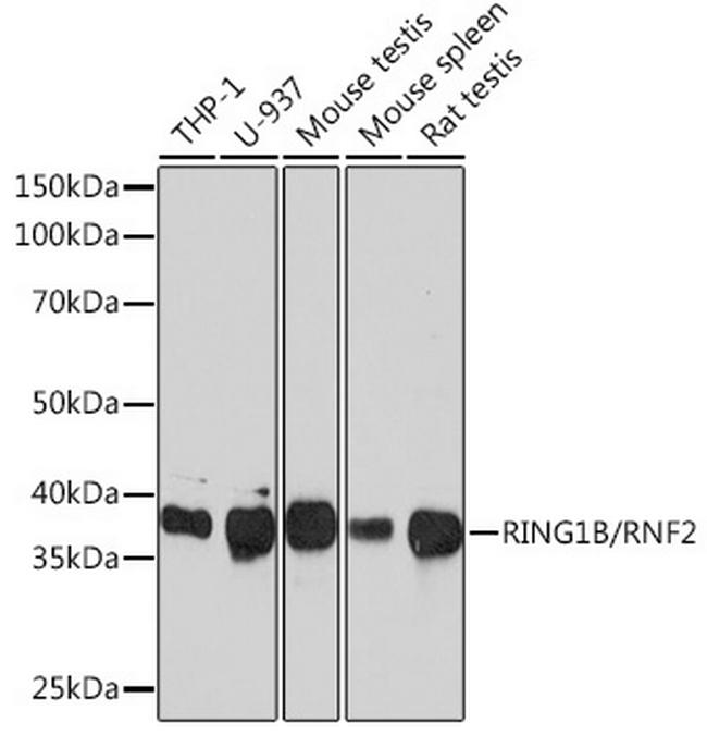 RNF2 Antibody in Western Blot (WB)