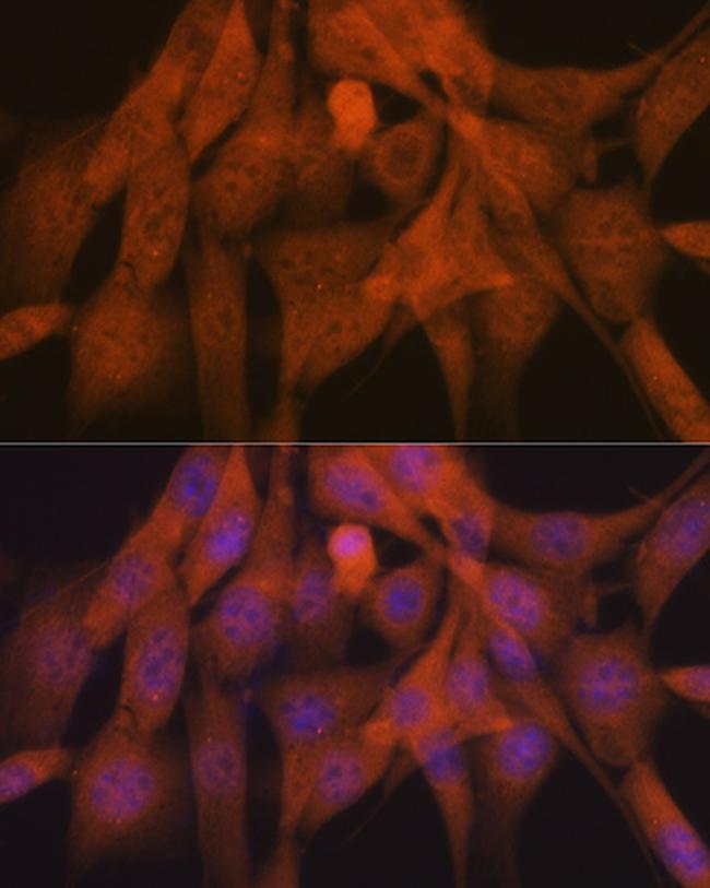 Ub-K48 Antibody in Immunocytochemistry (ICC/IF)