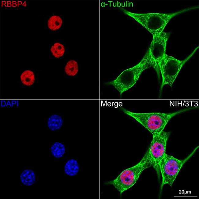 RbAp48 Antibody in Immunocytochemistry (ICC/IF)