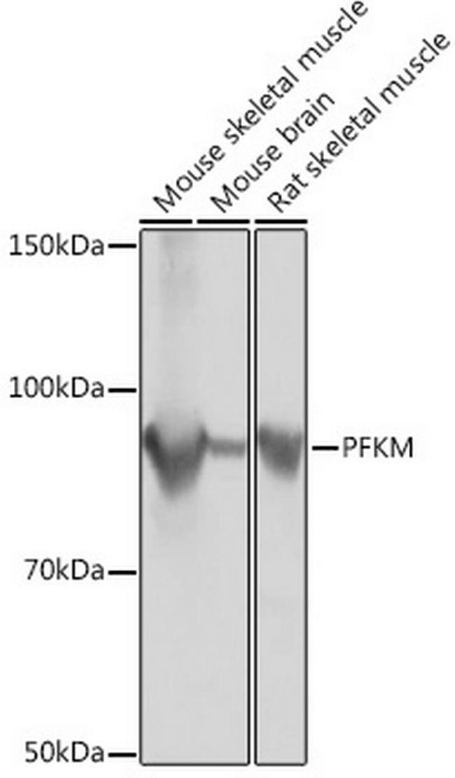 PFKM Antibody in Western Blot (WB)