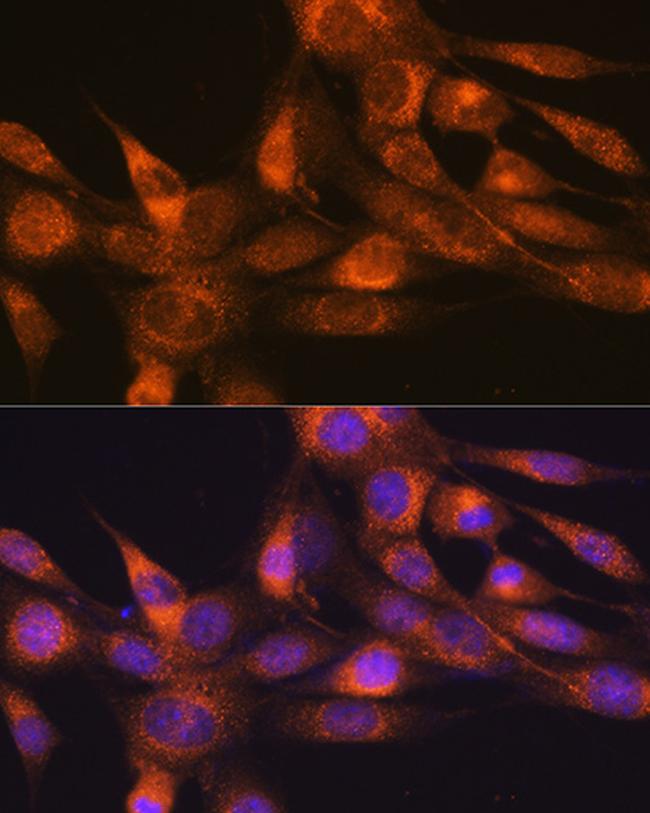 RHEB Antibody in Immunocytochemistry (ICC/IF)