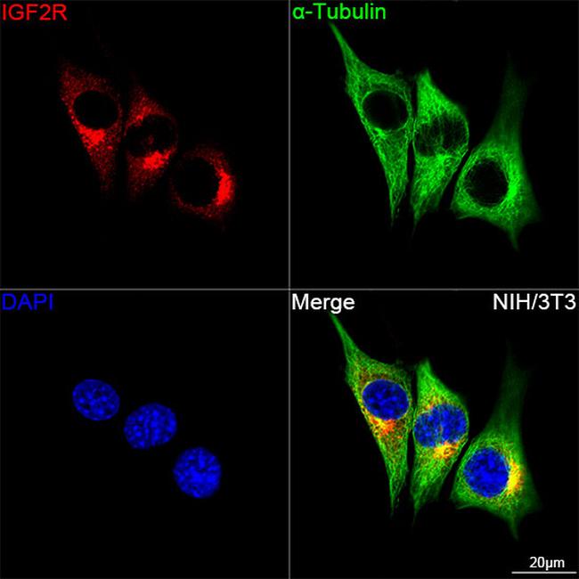 IGF2R Antibody in Immunocytochemistry (ICC/IF)