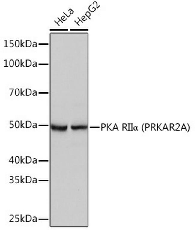 PRKAR2A Antibody in Western Blot (WB)