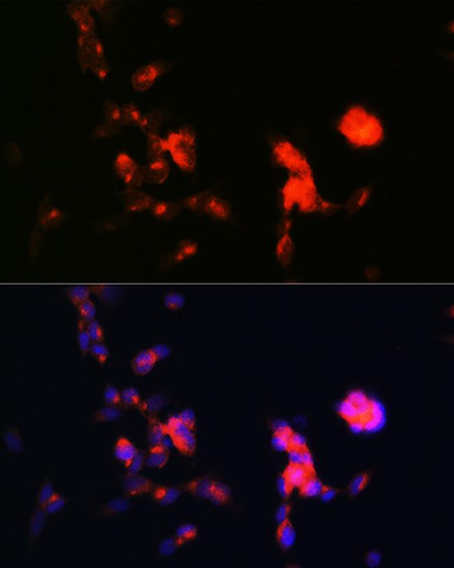 DKK3 Antibody in Immunocytochemistry (ICC/IF)