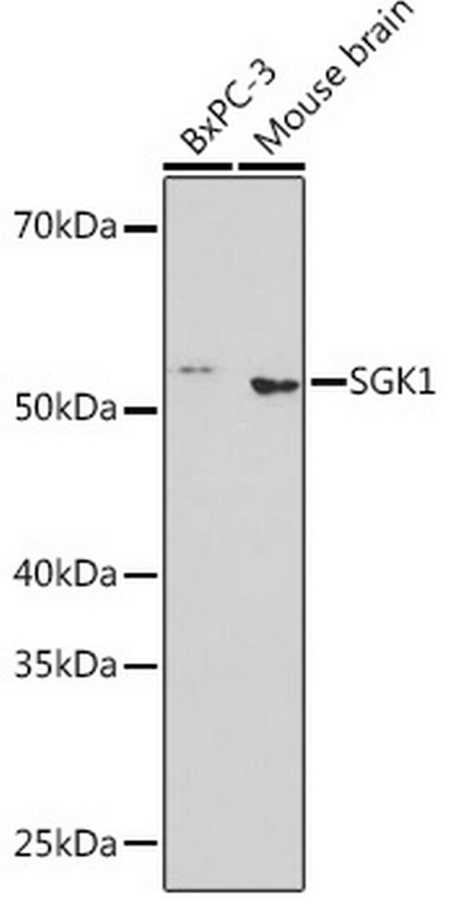 SGK1 Antibody in Western Blot (WB)