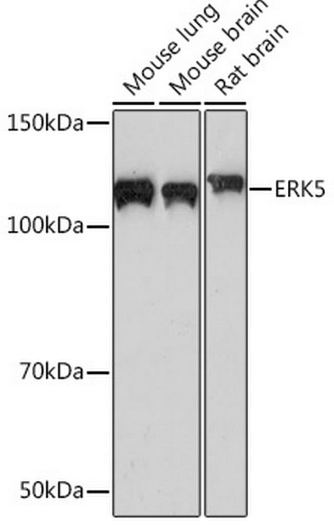 ERK5 Antibody in Western Blot (WB)