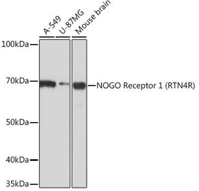 Nogo Receptor Antibody in Western Blot (WB)