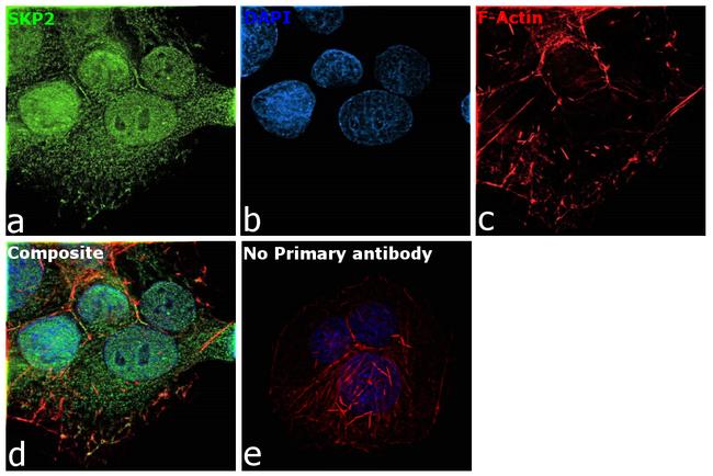 SKP2 Antibody in Immunocytochemistry (ICC/IF)