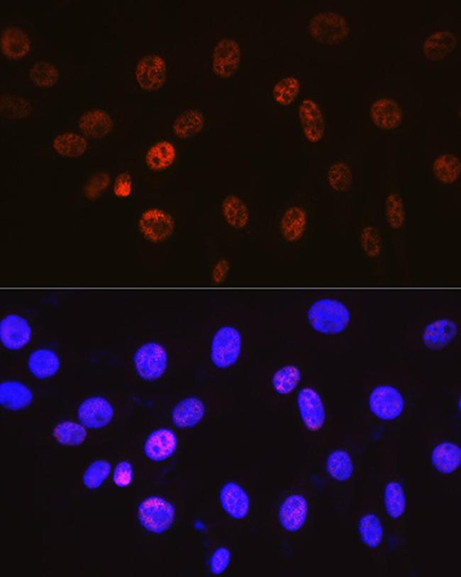 Cyclin H Antibody in Immunocytochemistry (ICC/IF)