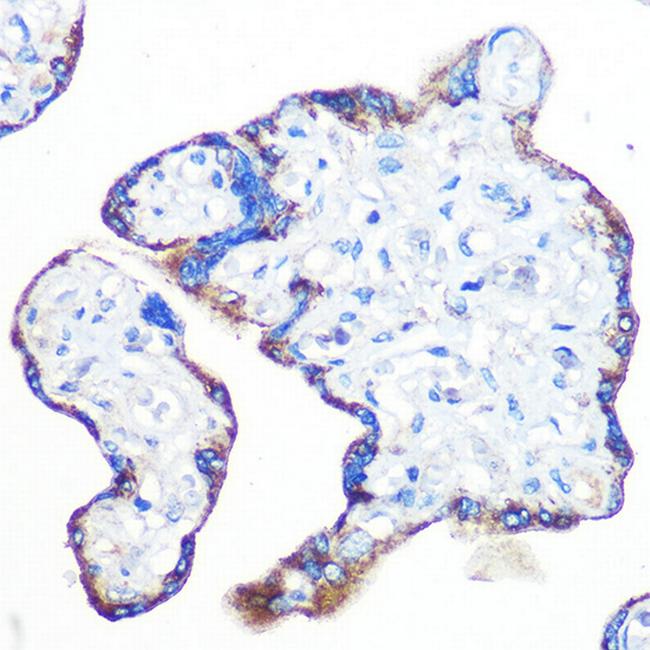 RAPGEF3 Antibody in Immunohistochemistry (Paraffin) (IHC (P))