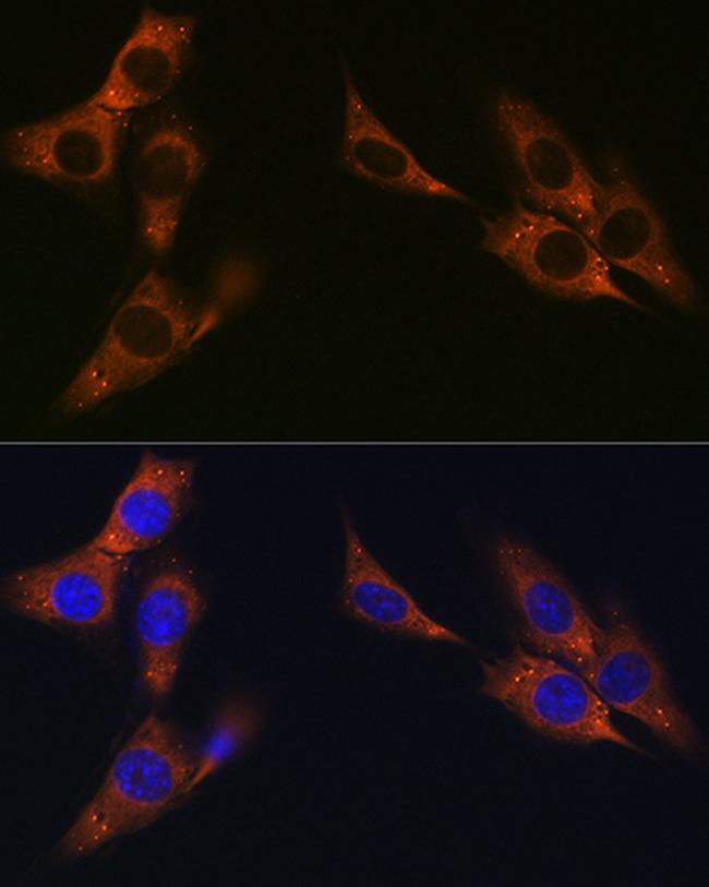 gamma Catenin Antibody in Immunocytochemistry (ICC/IF)