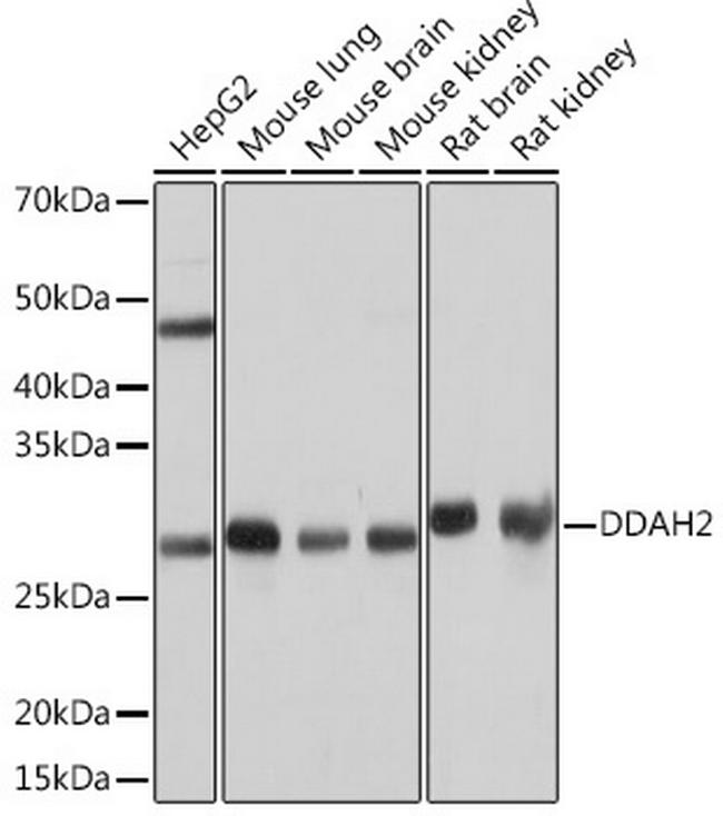 DDAH2 Antibody in Western Blot (WB)