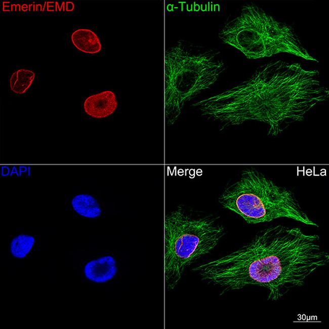 Emerin Antibody in Immunocytochemistry (ICC/IF)