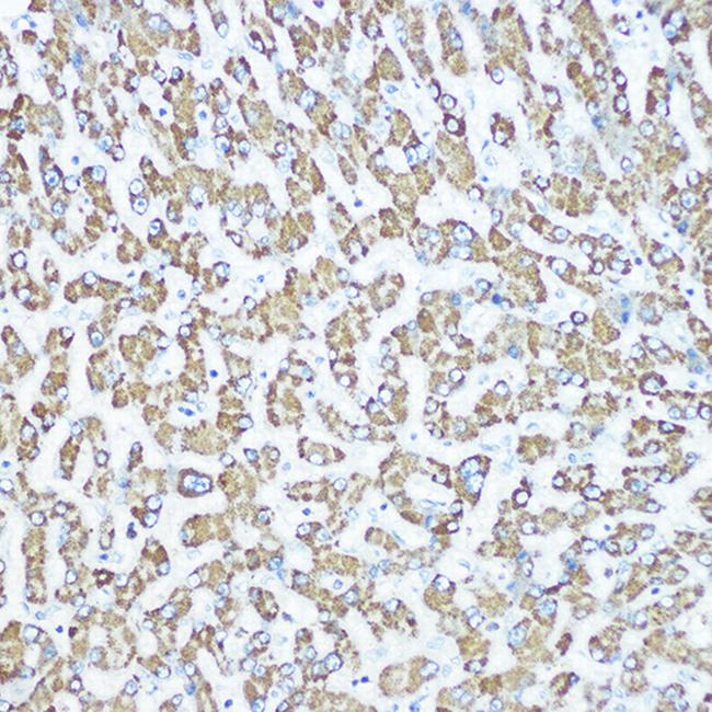 CPS1 Antibody in Immunohistochemistry (Paraffin) (IHC (P))