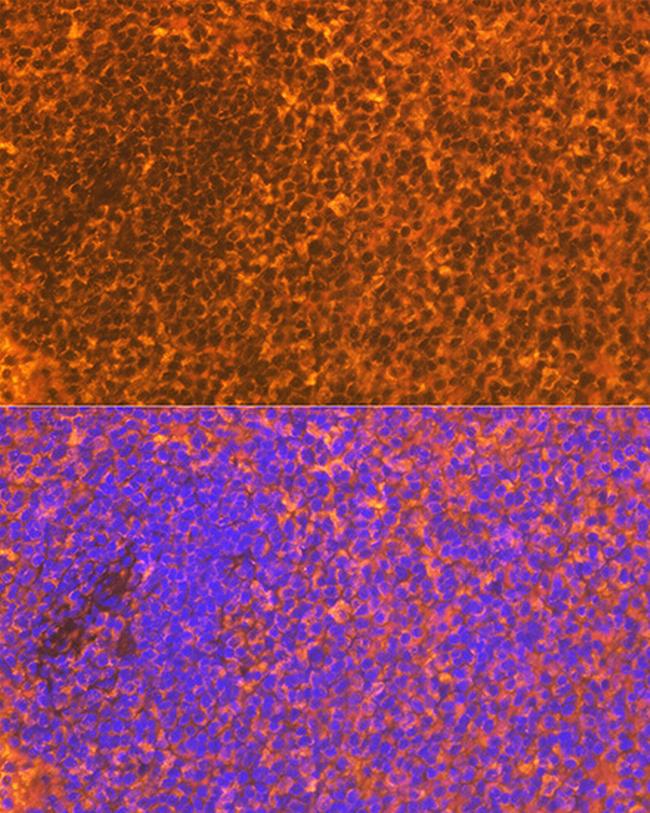 CD83 Antibody in Immunohistochemistry (Paraffin) (IHC (P))