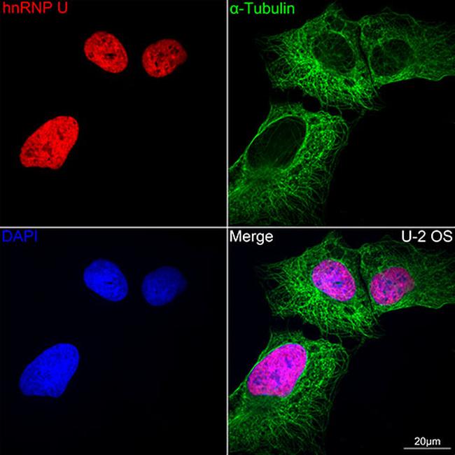 hnRNP U Antibody in Immunocytochemistry (ICC/IF)