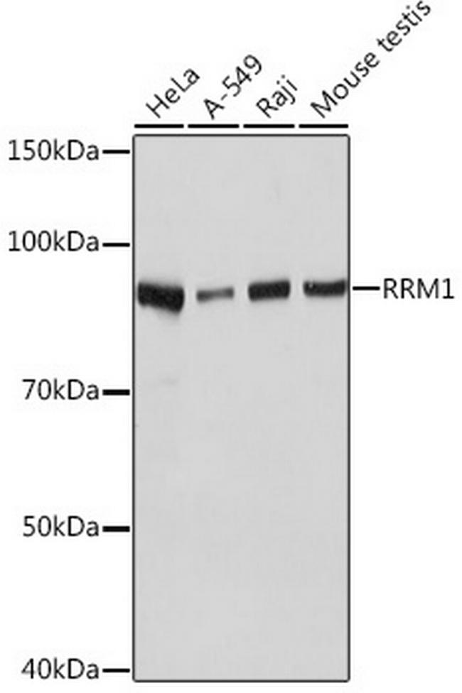 RRM1 Antibody in Western Blot (WB)