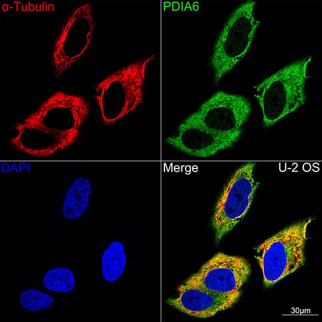 PDIA6 Antibody in Immunocytochemistry (ICC/IF)