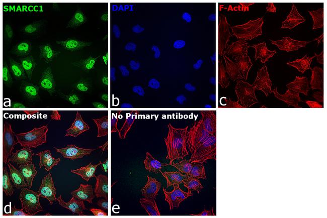 SMARCC1 Antibody in Immunocytochemistry (ICC/IF)