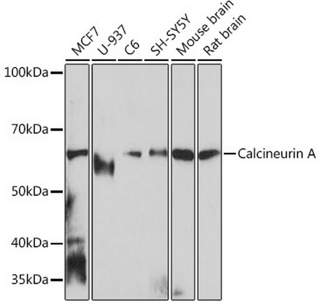 Calcineurin A Antibody in Western Blot (WB)