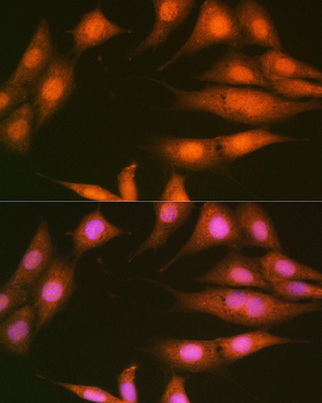 PP1 beta Antibody in Immunocytochemistry (ICC/IF)