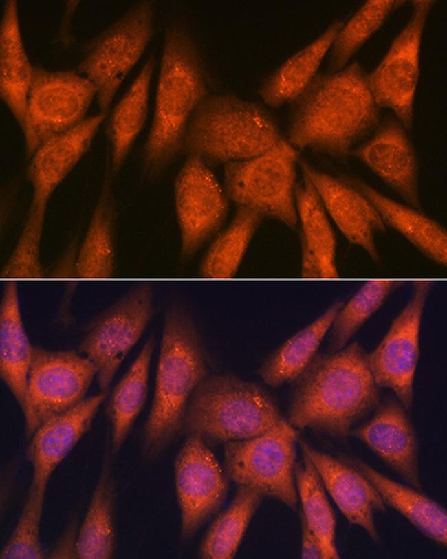 Laminin beta-1 Antibody in Immunocytochemistry (ICC/IF)