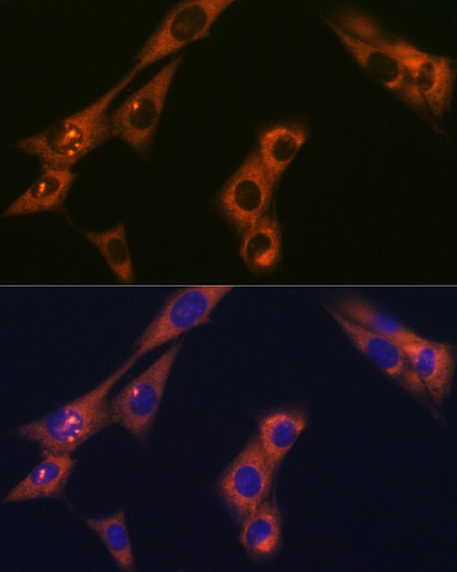 alpha Adaptin Antibody in Immunocytochemistry (ICC/IF)