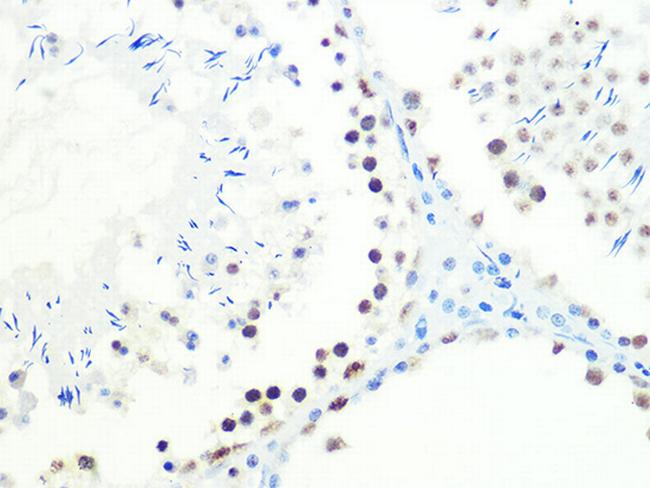 DKC1 Antibody in Immunohistochemistry (Paraffin) (IHC (P))