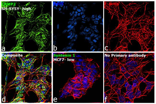 CRMP2 Antibody in Immunocytochemistry (ICC/IF)