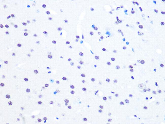 NuMA Antibody in Immunohistochemistry (Paraffin) (IHC (P))