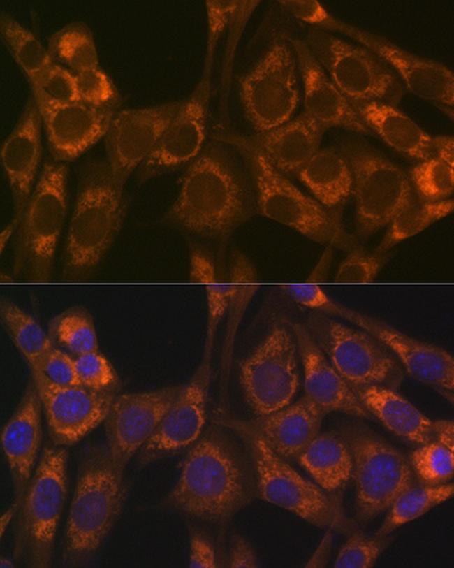 Thioredoxin 2 Antibody in Immunocytochemistry (ICC/IF)