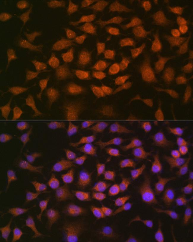 GRK2 Antibody in Immunocytochemistry (ICC/IF)