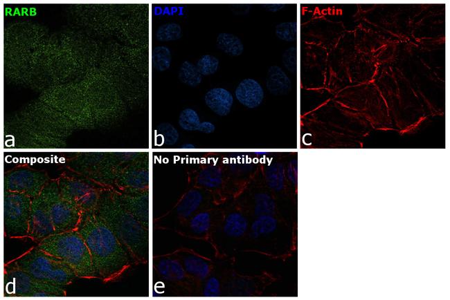 RARB Antibody in Immunocytochemistry (ICC/IF)