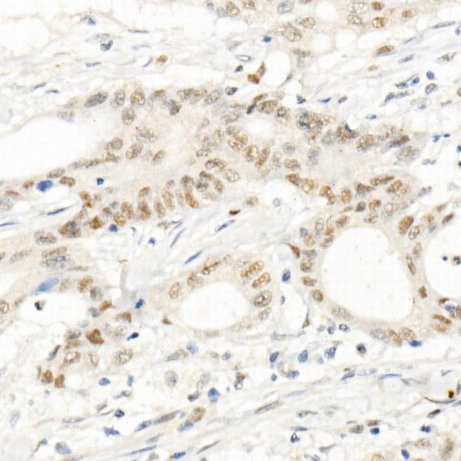 PMS2 Antibody in Immunohistochemistry (Paraffin) (IHC (P))