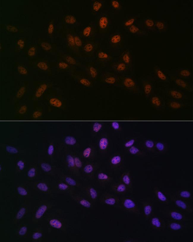 MTA2 Antibody in Immunocytochemistry (ICC/IF)