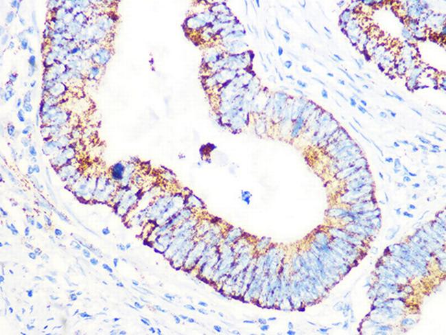 PDHB Antibody in Immunohistochemistry (Paraffin) (IHC (P))