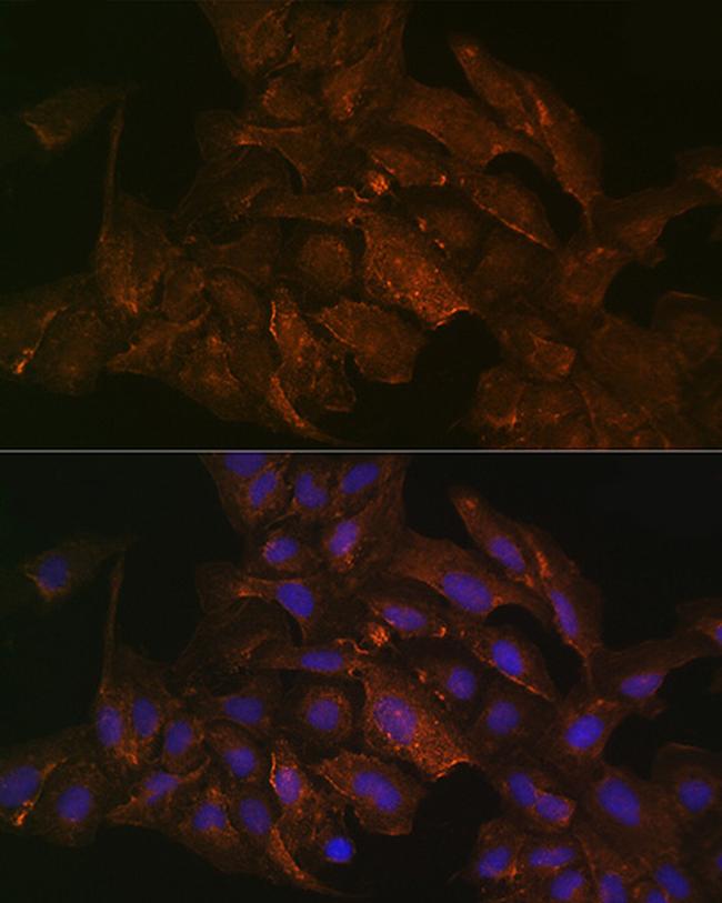 Pan Ras Antibody in Immunocytochemistry (ICC/IF)