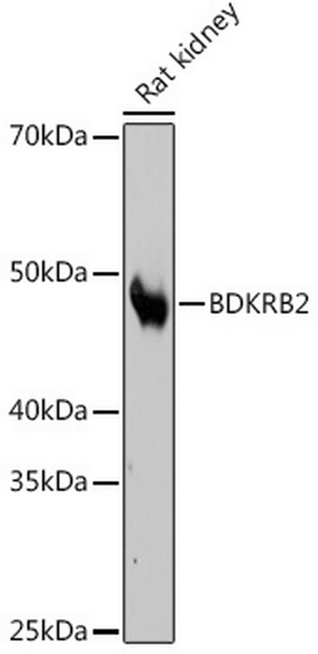 BDKRB2 Antibody in Western Blot (WB)