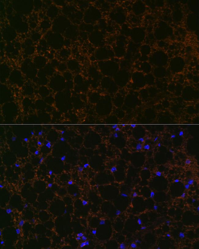 Perilipin 1 Antibody in Immunocytochemistry (ICC/IF)