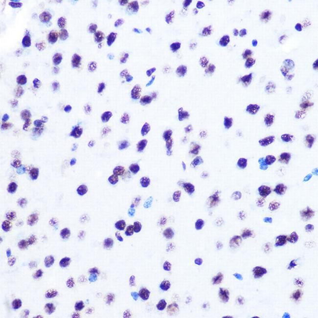 Hydroxyl-Histone H2A (Tyr39) Antibody in Immunohistochemistry (Paraffin) (IHC (P))