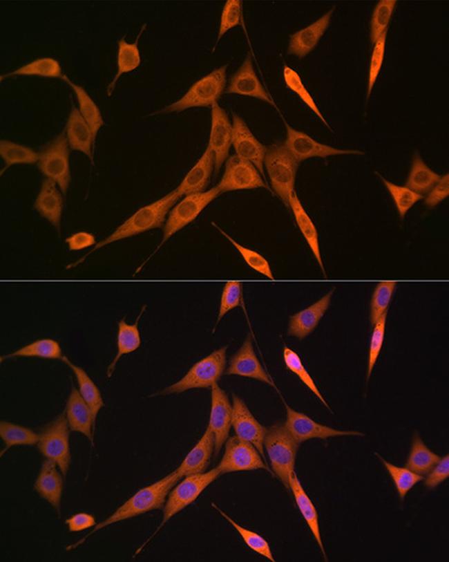 RhoA/RhoB/RhoC Antibody in Immunocytochemistry (ICC/IF)