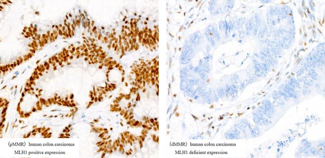 MLH1 Antibody in Immunohistochemistry (Paraffin) (IHC (P))