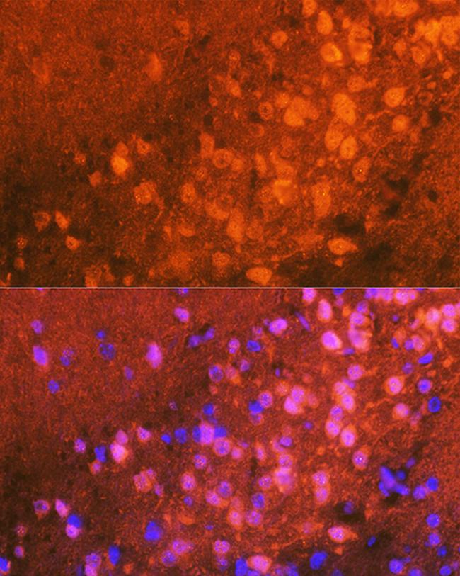 JNK1/JNK2/JNK3 Antibody in Immunohistochemistry (Paraffin) (IHC (P))