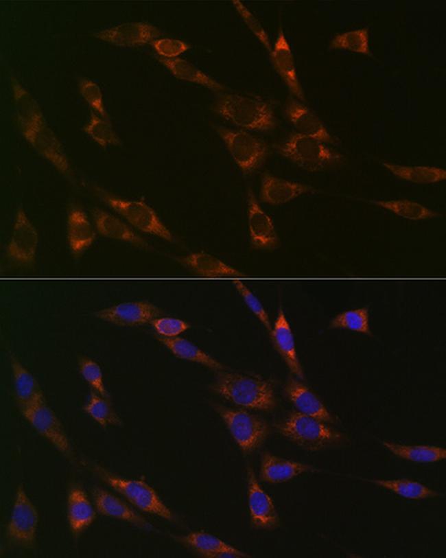 RPS3 Antibody in Immunocytochemistry (ICC/IF)