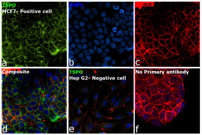 TSPO Antibody in Immunocytochemistry (ICC/IF)