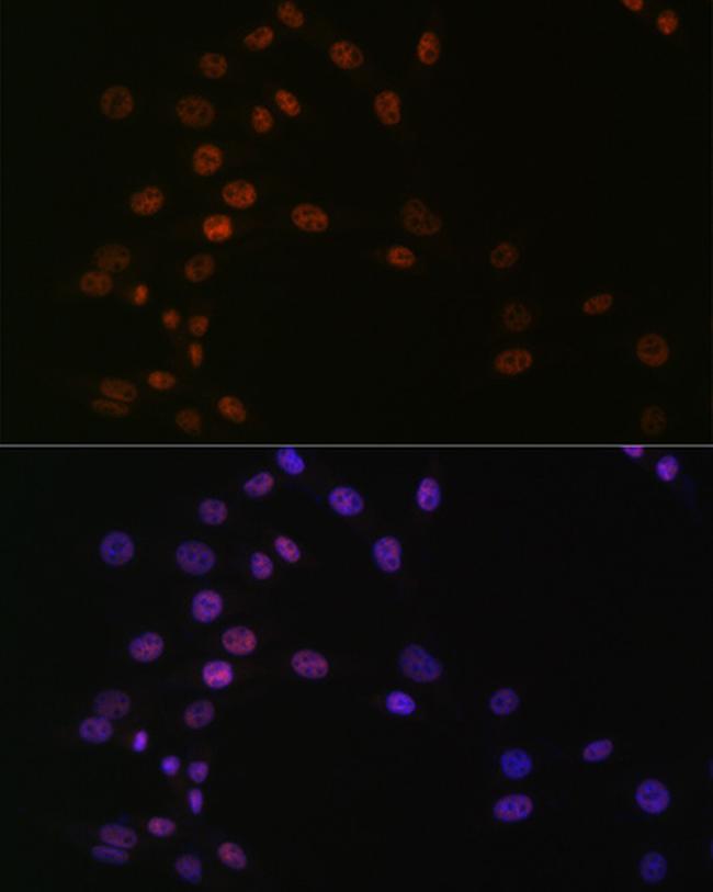 ASH2L Antibody in Immunocytochemistry (ICC/IF)