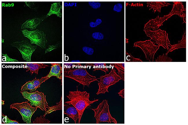 RAB9 Antibody in Immunocytochemistry (ICC/IF)