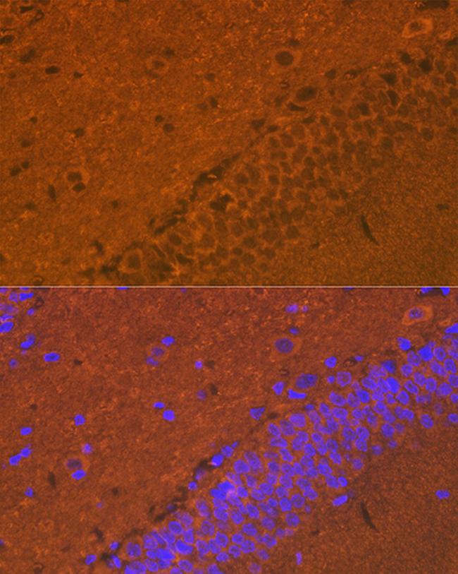 Synuclein alpha/beta Antibody in Immunohistochemistry (Paraffin) (IHC (P))