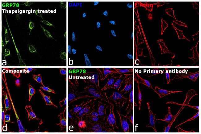 GRP78 Antibody in Immunocytochemistry (ICC/IF)