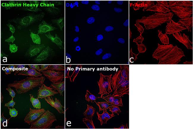 Clathrin Heavy Chain Antibody in Immunocytochemistry (ICC/IF)